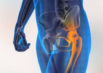 Best Orthopedic Surgeon In Meerut