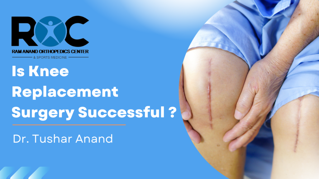 Is Knee Replacement Surgery Successful?