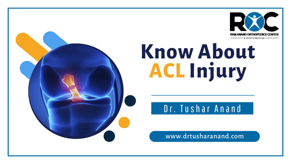 Everything You Need to Know About ACL Injuries