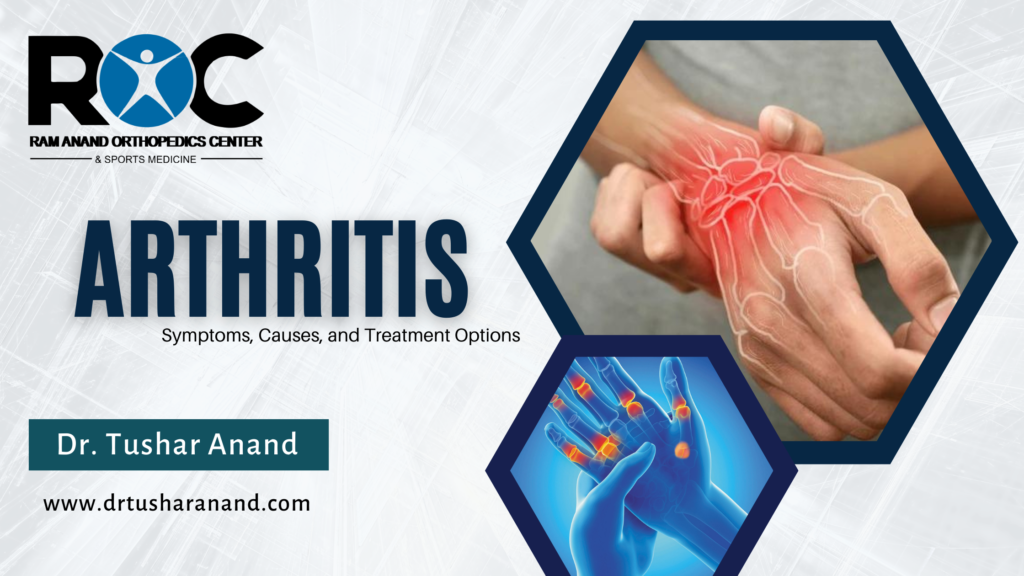 Understanding Arthritis: Symptoms, Causes, and Treatment