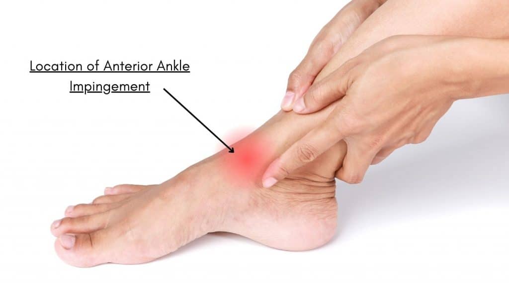 Common Foot and Ankle Injuries in Athletes