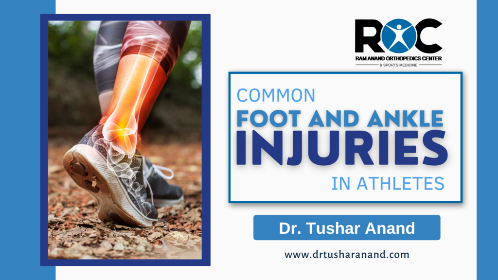 Common Foot and Ankle Injuries in Athletes