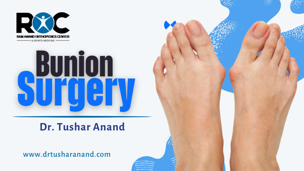 Bunion Surgery: Treatment & Recovery