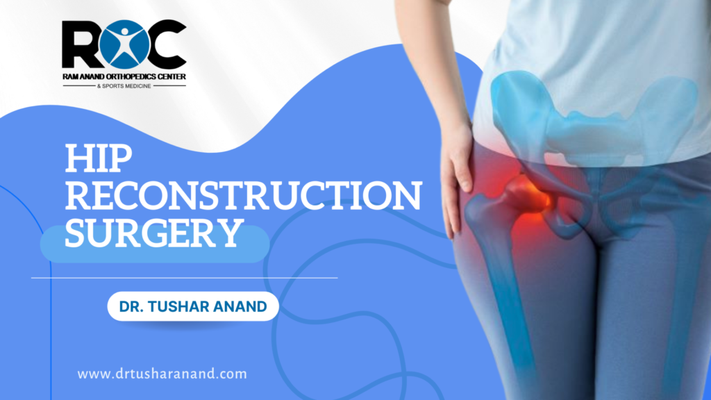 Hip Reconstruction Surgery