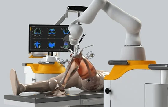 Robotic Knee Replacement