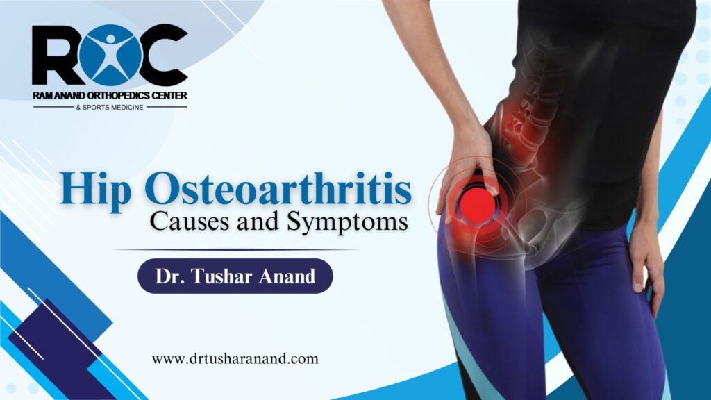 Understanding Hip Osteoarthritis: Causes and Symptoms