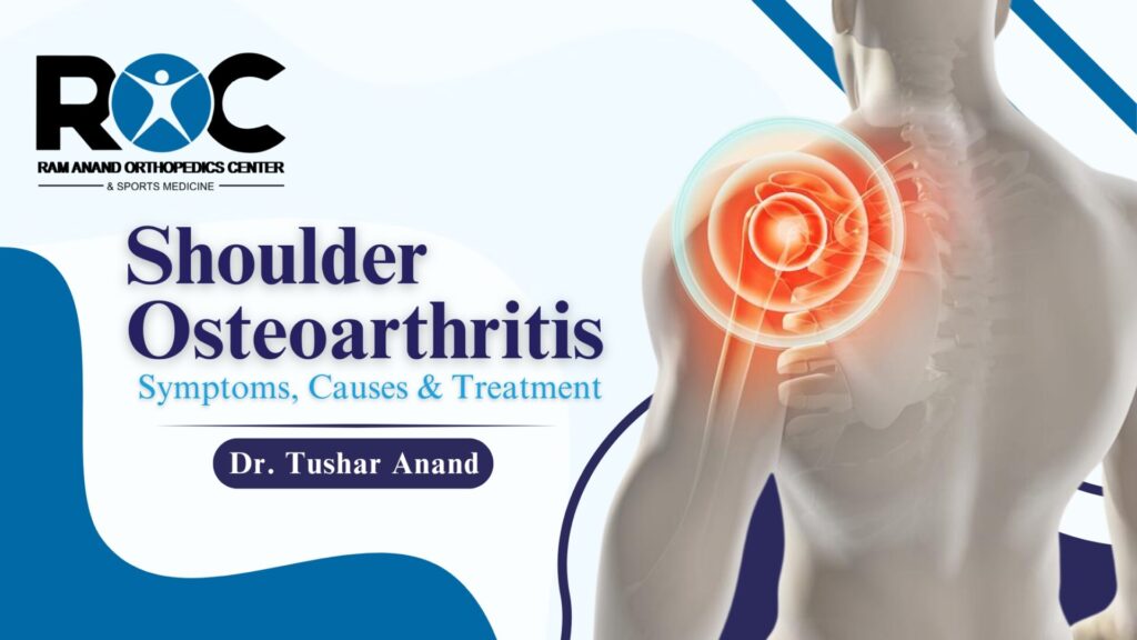 Shoulder Osteoarthritis – Symptoms, Causes & Treatment