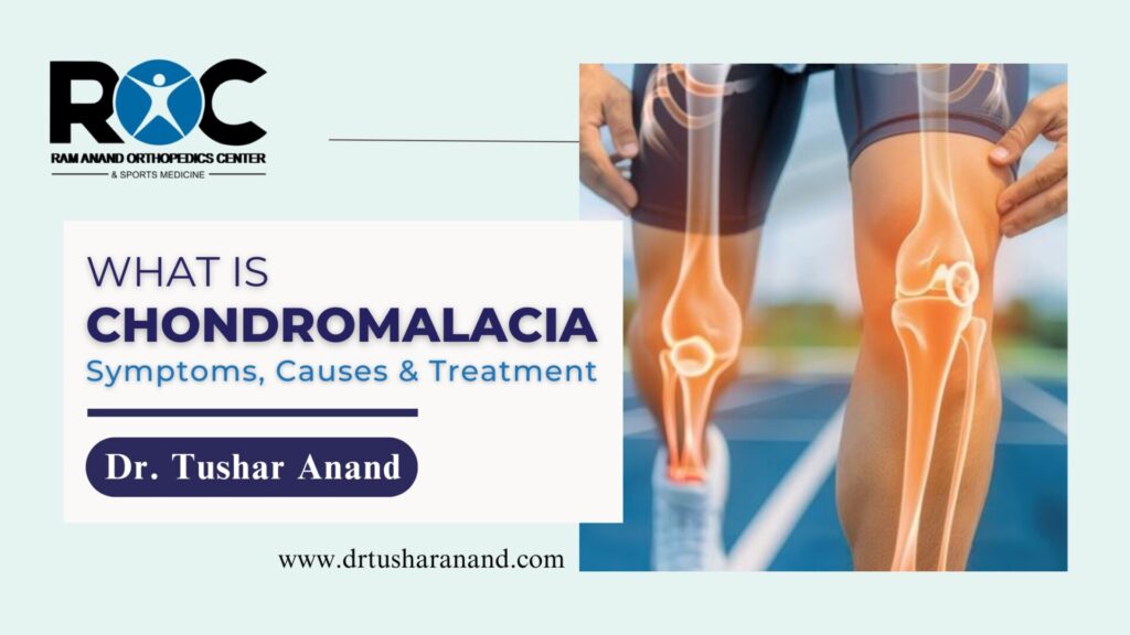 Chondromalacia: Causes, Symptoms, and Treatment Options