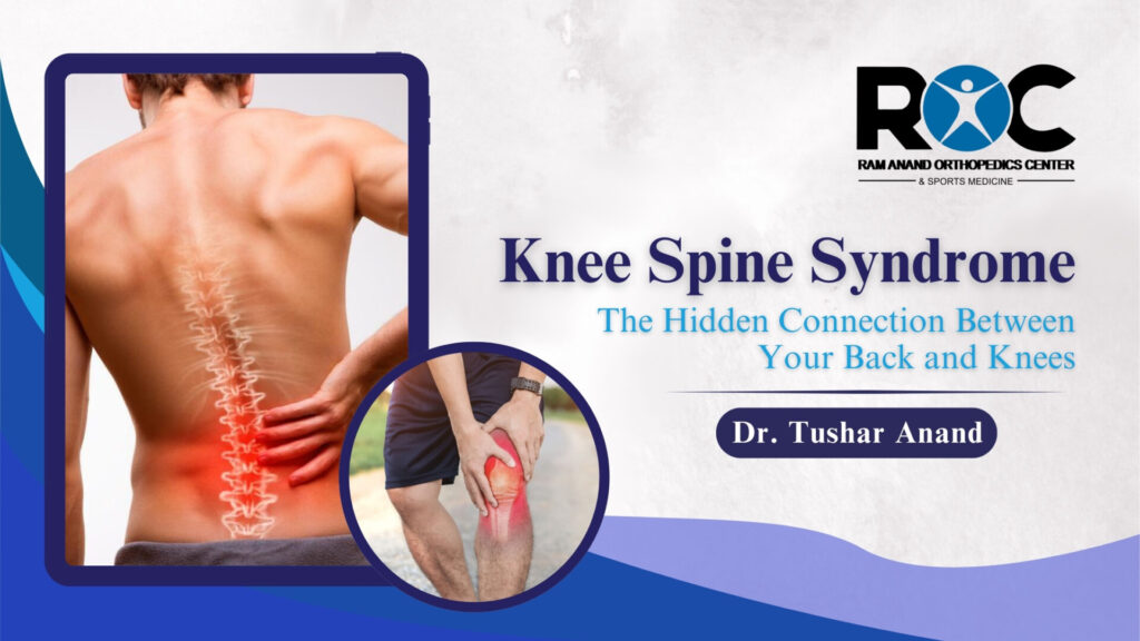 Knee Spine Syndrome: The Hidden Connection Between Your Back and Knees